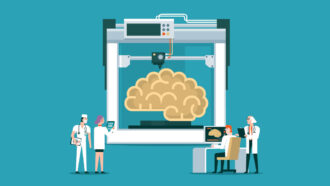 an illustration of researchers examining a large brain