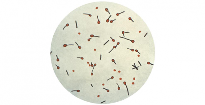 a microscopic image of the Clostridium tetani bacteria